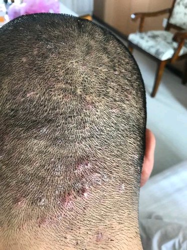 ”请问戒友这个怎么治？正规医院去看了4.5会了，万把块钱砸进去