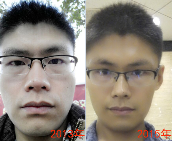 ”【成长记录】暴照，吃素两年，戒色一年效果