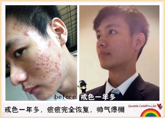 ”痘坑，忏悔，沉伯，对象，誓言，祝福。