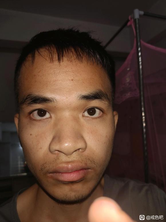 ”天天遗精滑精怎么调理