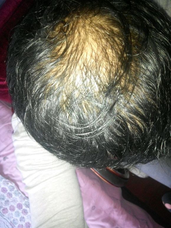 ”【成长记录】sy20年，戒色一个月头发对比！