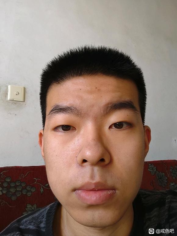 ”恢复需要多长时间