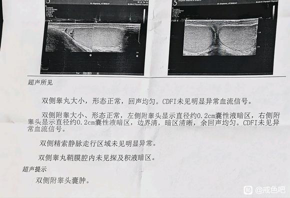 ”#微信看病卖药是假的#sy导致早泄