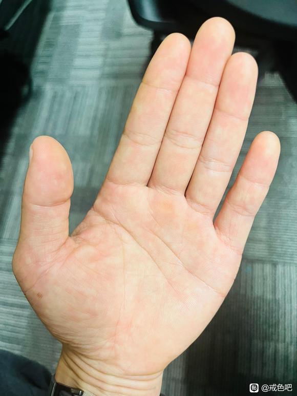 ”最近新发现生命线断开处居然连接起来了