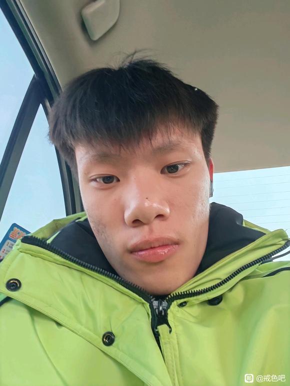 ”戒色10天的面部变化