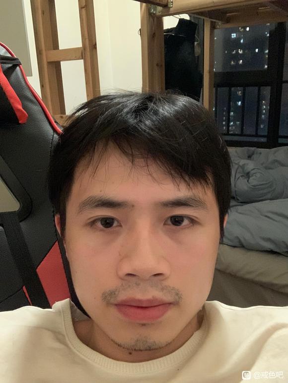 ”请问下师兄们看一下我面相伤到什么程度了