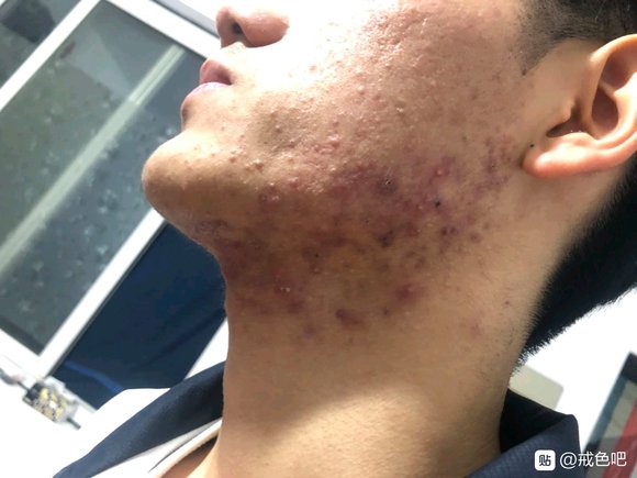 ”戒色前后对比图，精选28张好兄弟们一起努力了