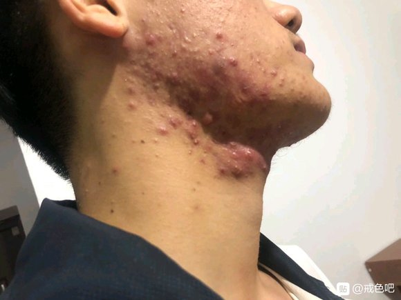 ”戒色前后对比图，精选28张好兄弟们一起努力了