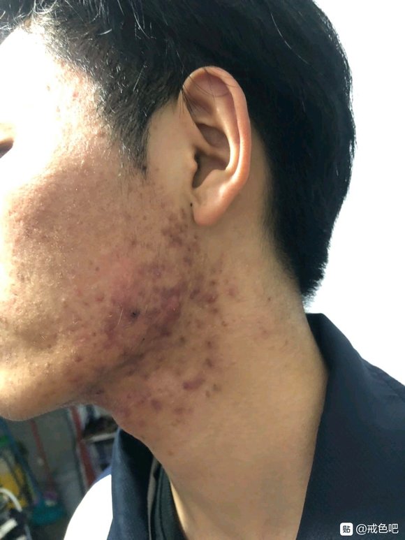 ”戒色前后对比图，精选28张好兄弟们一起努力了