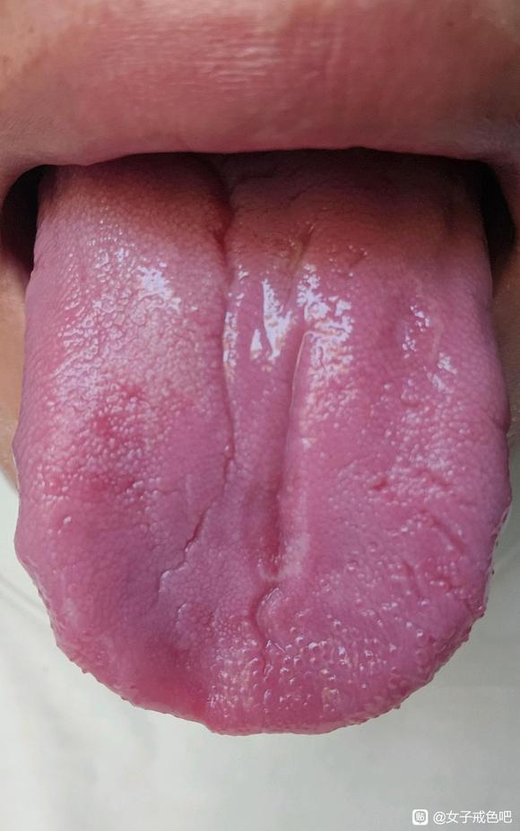 ”戒了10天，舌头开始有血色，不是之前泛白