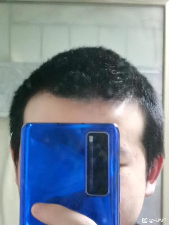 ”头发好像变得有点硬了，是肾气在恢复吗？