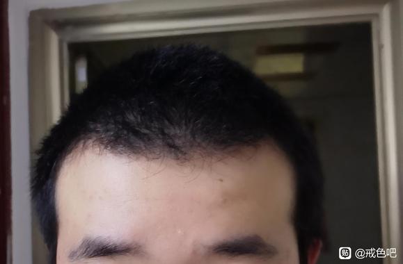 ”头发好像变得有点硬了，是肾气在恢复吗？