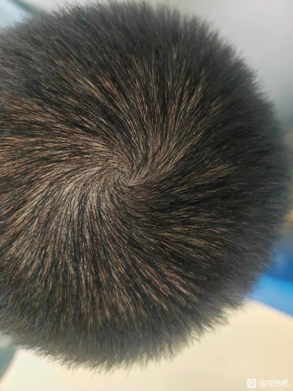 ”头发好像变得有点硬了，是肾气在恢复吗？