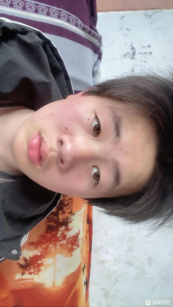 ”手淫过度折磨