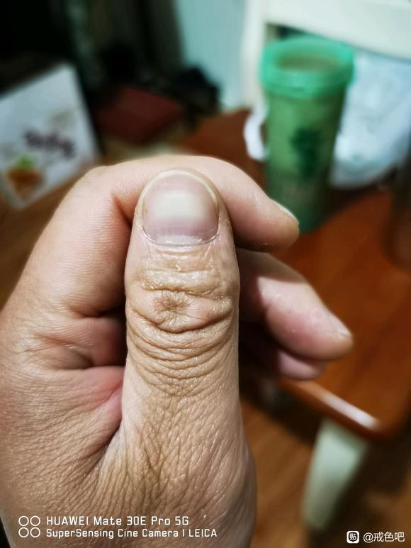 ”大拇指小月牙出来了