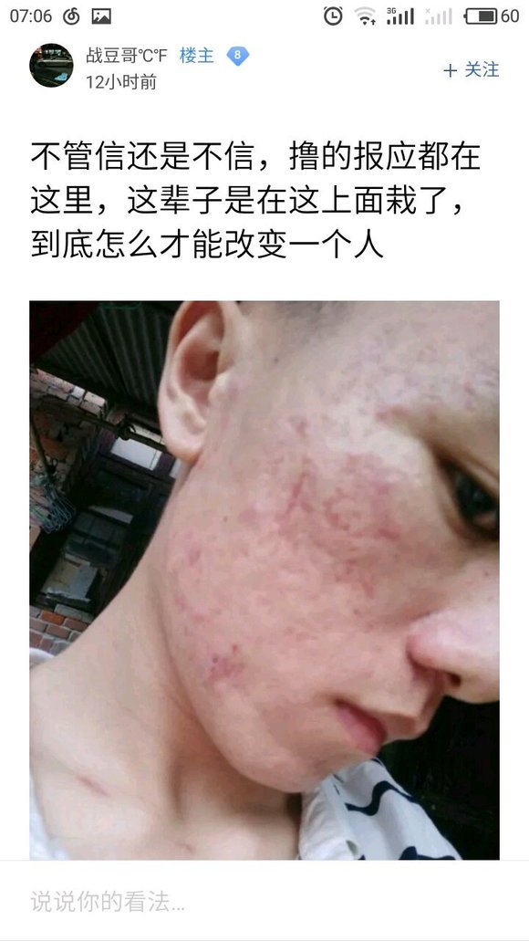 ”这几年来，我搜集了成千上万受到sy危害的案例，发给大家看看！