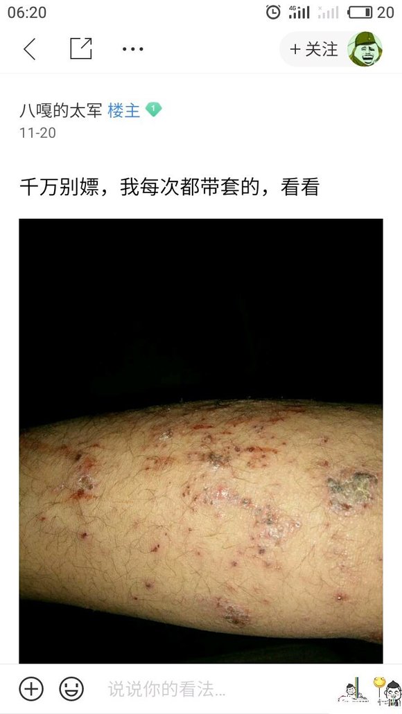 ”这几年来，我搜集了成千上万受到sy危害的案例，发给大家看看！