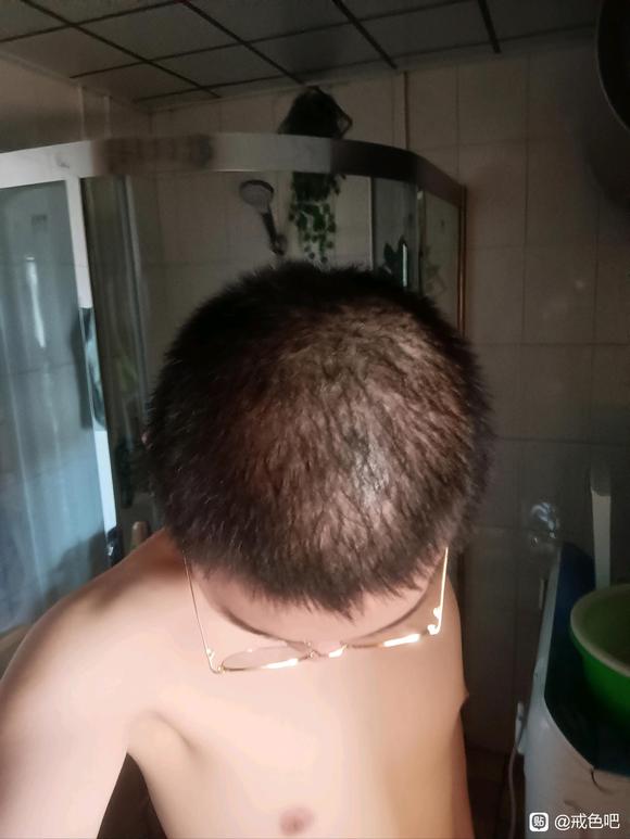 ”2021年染上的，两年了