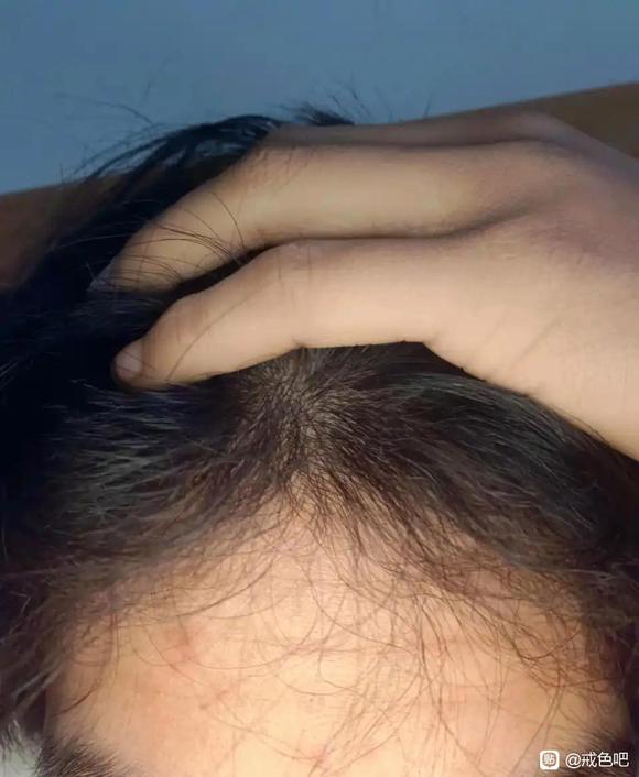 ”#微信看病卖药是假的#以前头发不卷