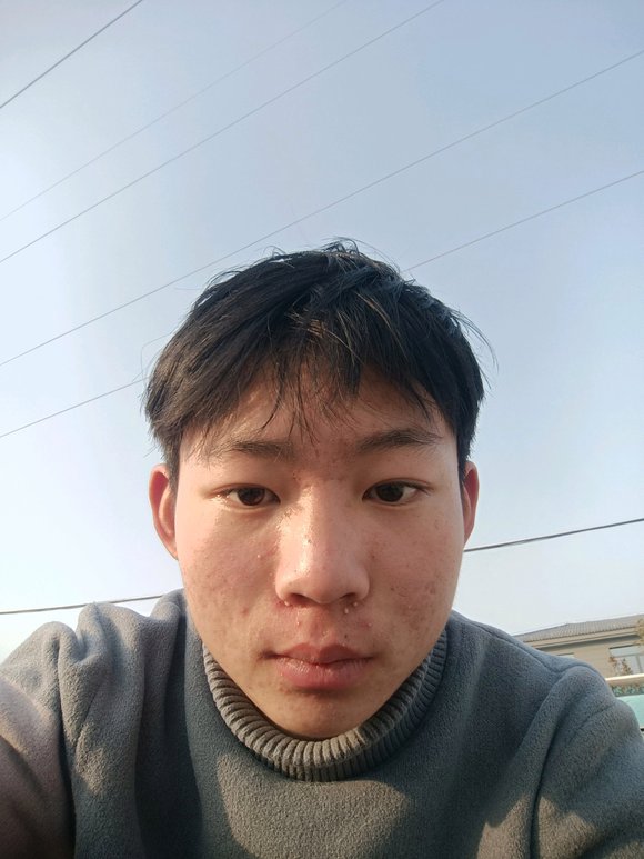 ”也戒s62天了，说说我的感悟吧！第一，脸上的痘痘好了好多，干