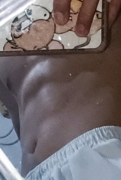 ”也戒s62天了，说说我的感悟吧！第一，脸上的痘痘好了好多，干