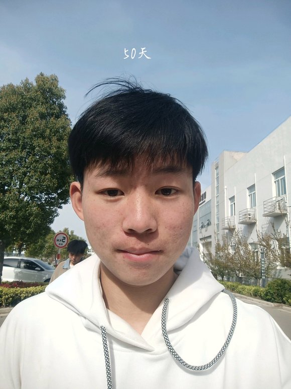 ”也戒s62天了，说说我的感悟吧！第一，脸上的痘痘好了好多，干