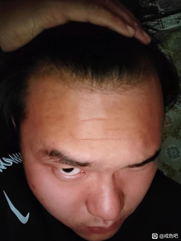 ”戒色50天的恢复效果