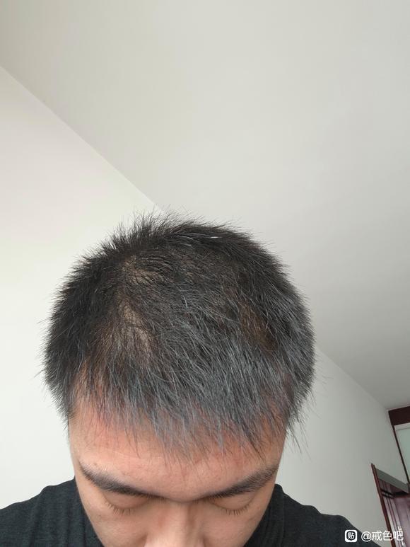 ”开始js，互相监督