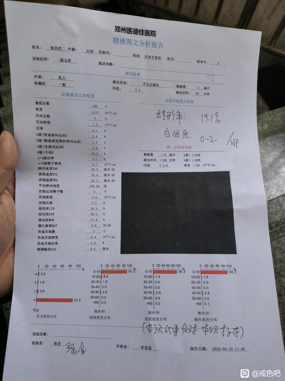 ”精子活力非常查