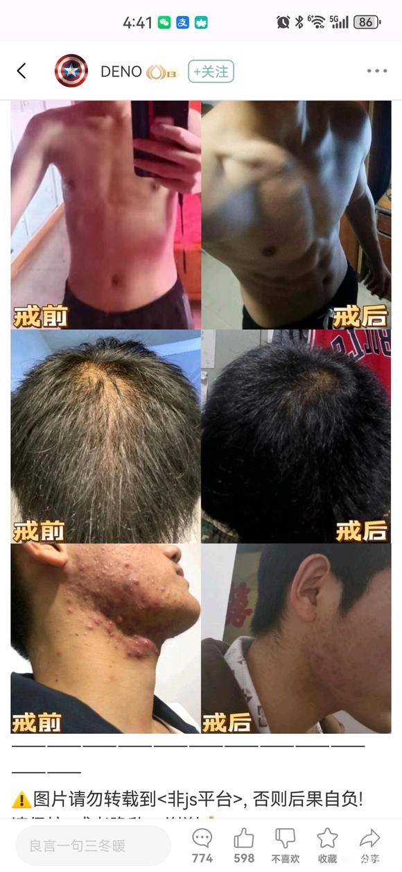 ”有发量恢复的真实案例吗