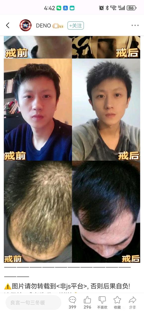 ”有发量恢复的真实案例吗