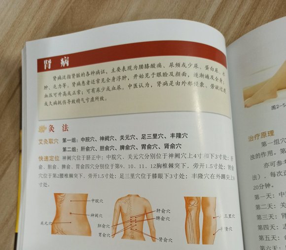 ”艾灸对神衰很有帮助