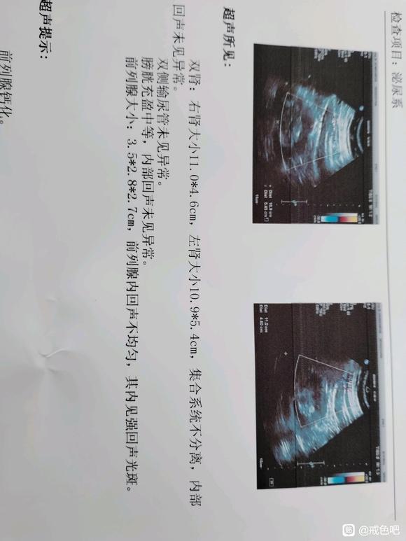 ”去肾内科检查了