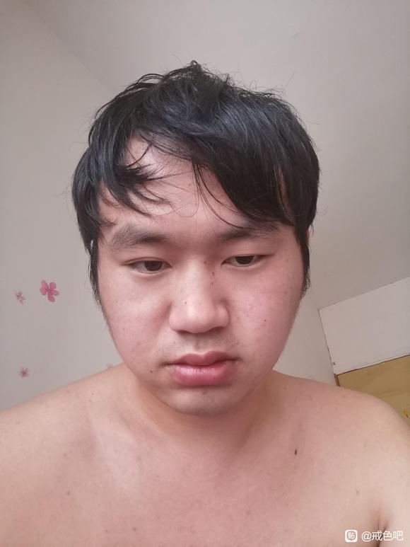 ”看起来多大了，4年多了，之前2年一天一次，脸都凹陷了