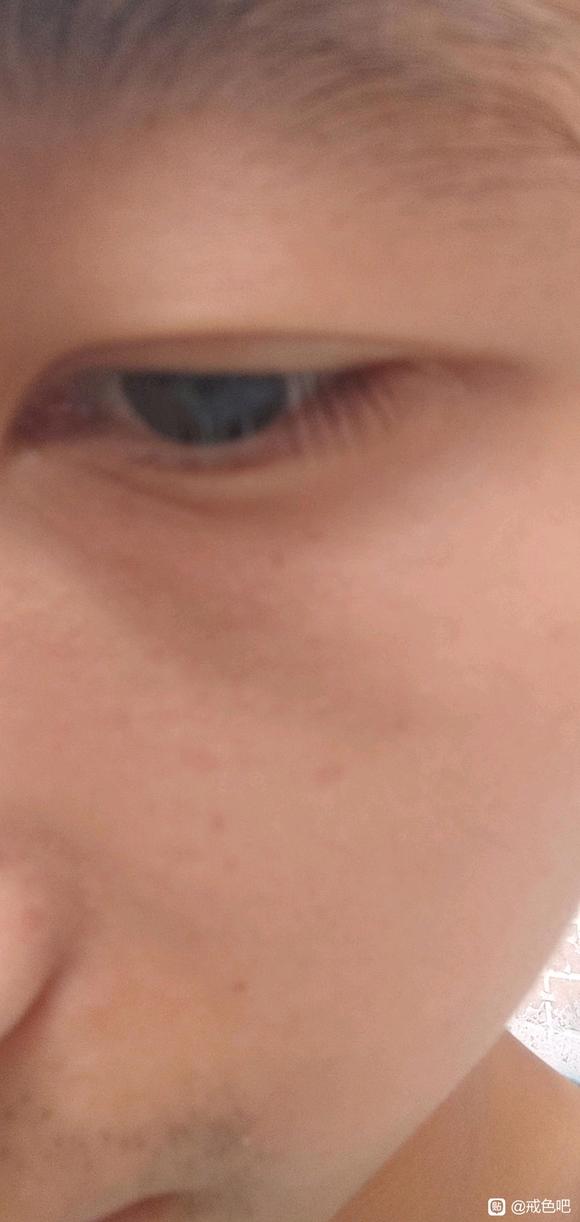 ”像我这种瘦不拉几，怎么才能增肌，黑眼圈怎么消除