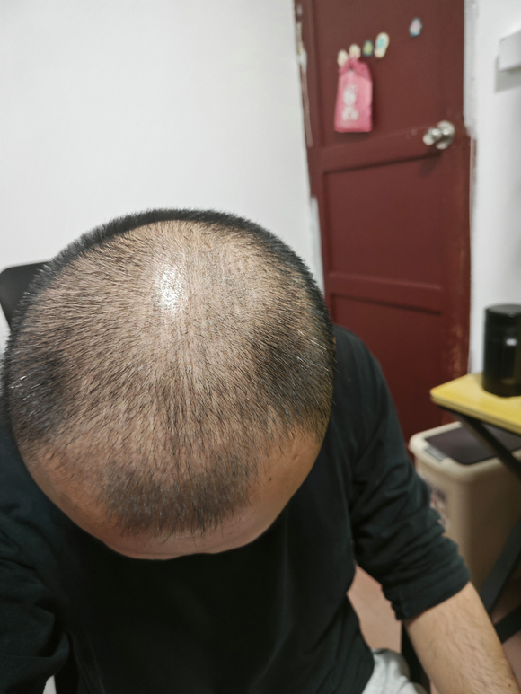 ”一直想戒掉，一直戒不掉