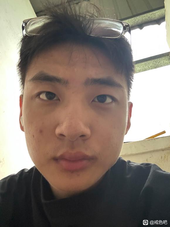 ”#微信看病卖药是假的#师兄们这两个哪个看起来更严重