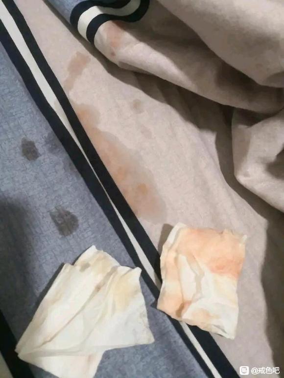 ”手淫会让人焦虑症