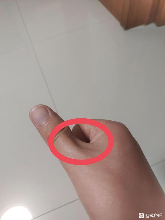 ”拇指这个部位不饱满是什么原因？