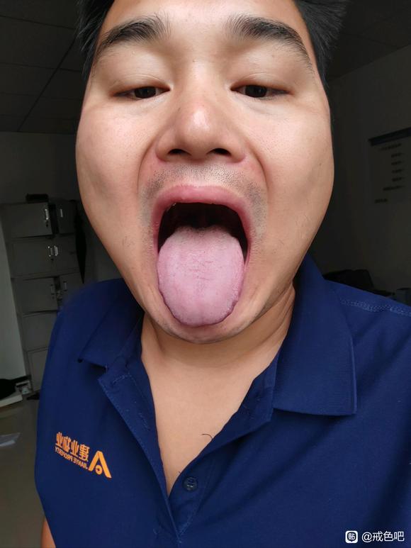 ”脾肾阳虚怎么治？