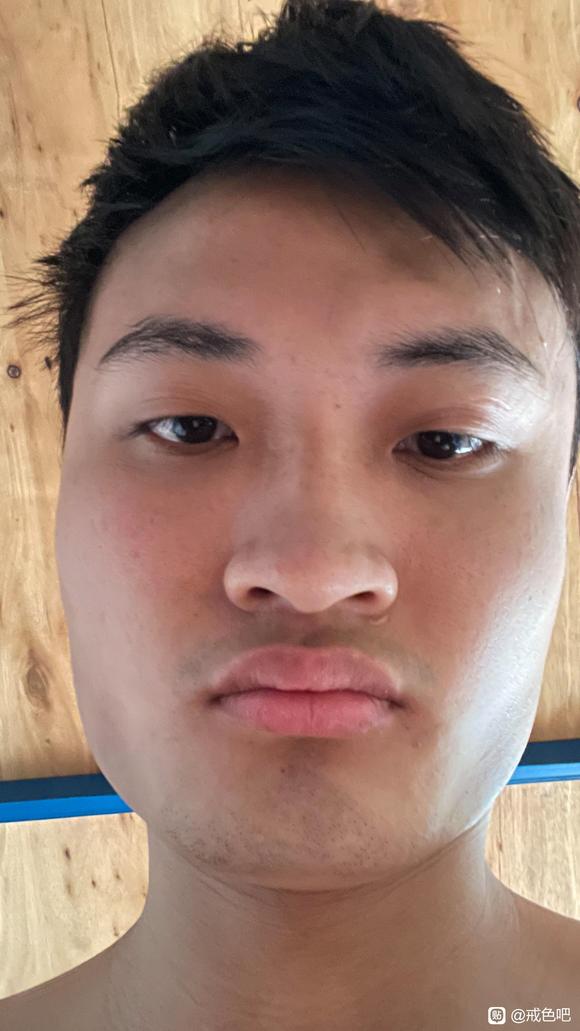 ”如何改变脸部凹陷