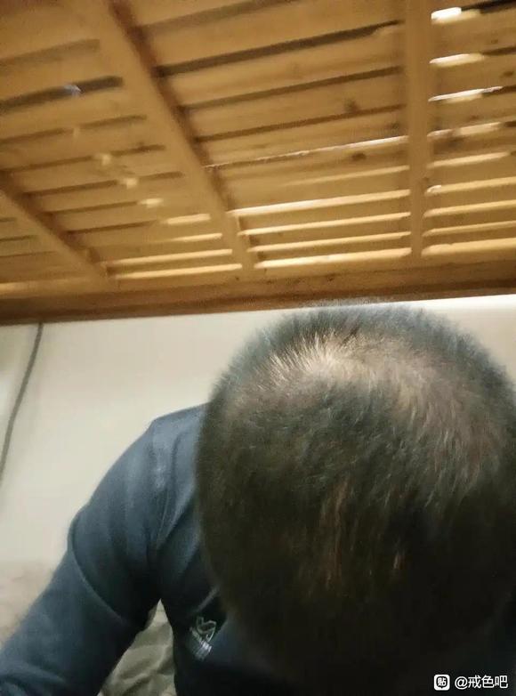 ”我这个算在恢复吗？