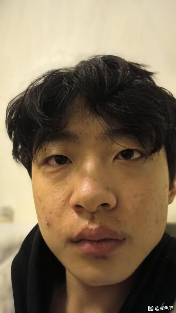 ”图为第1天和第139天，兄弟们看看有什么变化吗