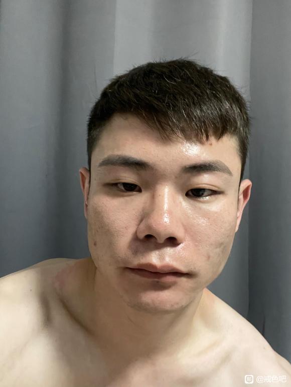 ”大家看看我的脸是不是畸形了