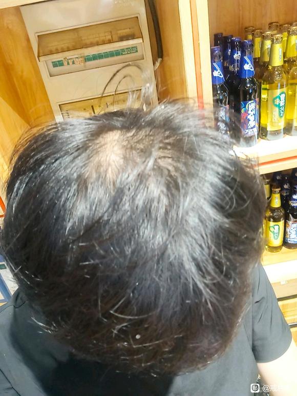 ”#微信看病卖药是假的#正在戒色还能恢复吗头发