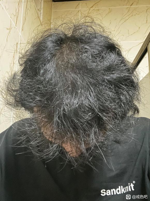 ”#微信看病卖药是假的#正在戒色还能恢复吗头发