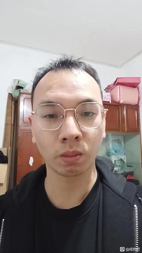 ”感恩，戒色之后脱发问题解决