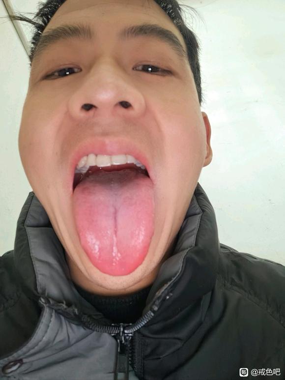 ”#微信看病卖药是假的#大神看看什么情况？