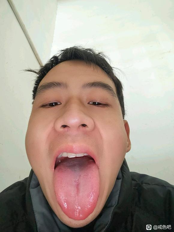 ”#微信看病卖药是假的#大神看看什么情况？