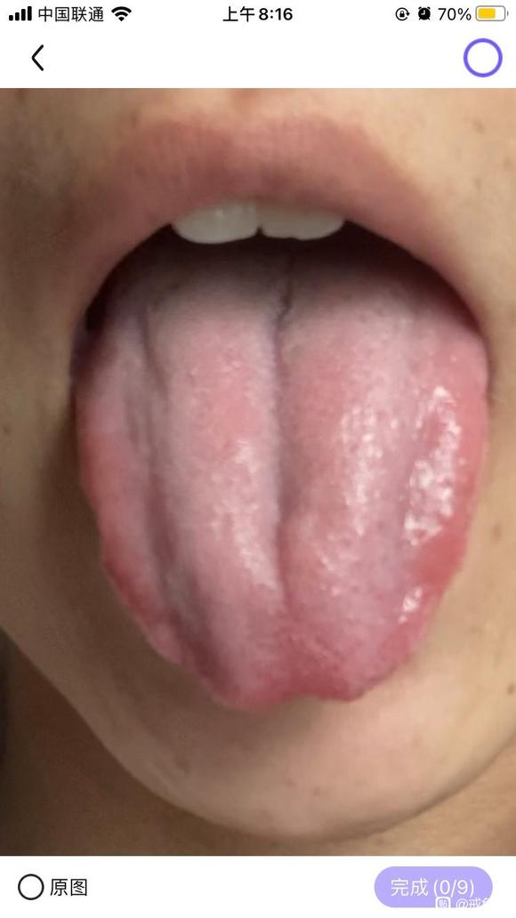 ”还有可能长胖吗，160